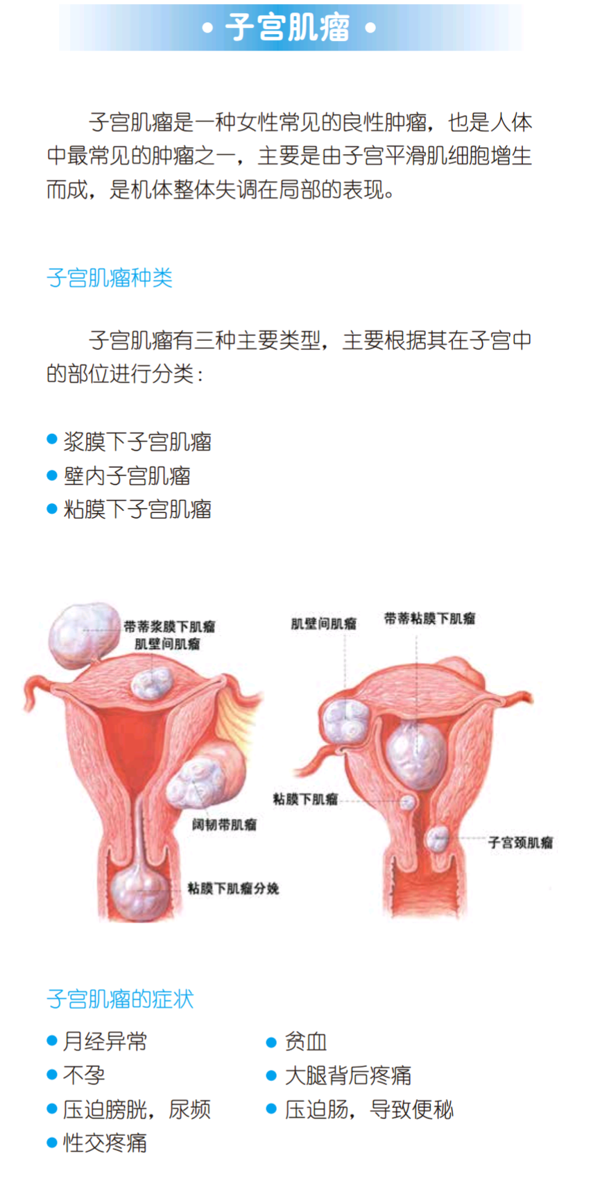 子宫腺肌症最新治疗步骤指南与解析