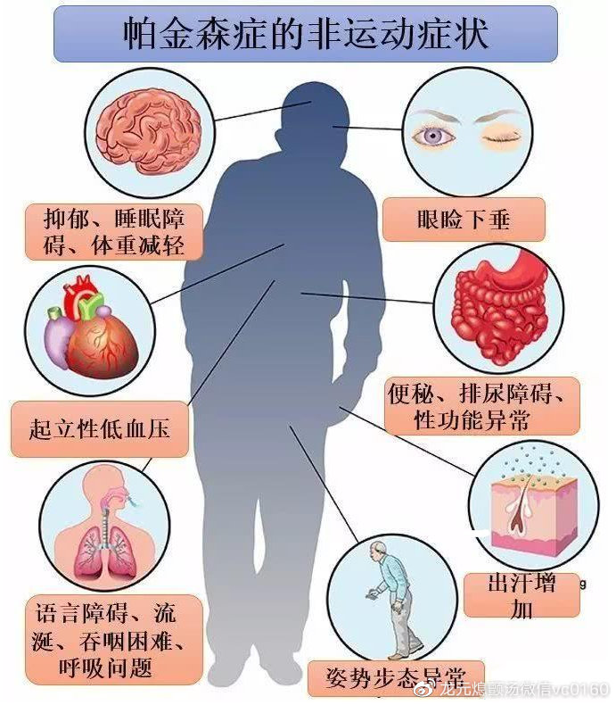 帕金森最新治疗方法的探索之旅