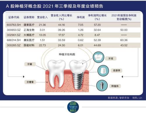 种植牙集采最新动态及步骤指南揭秘